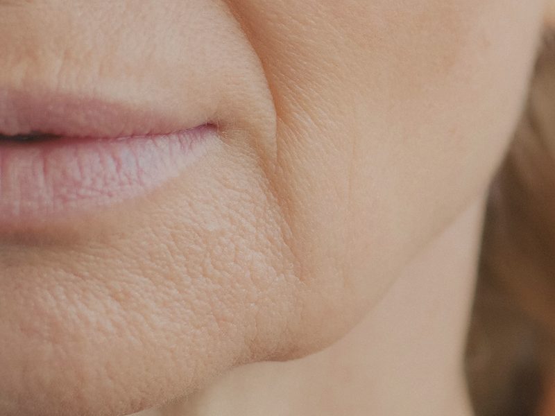 Close-up of the lower face showing the jowl and jawline in soft light