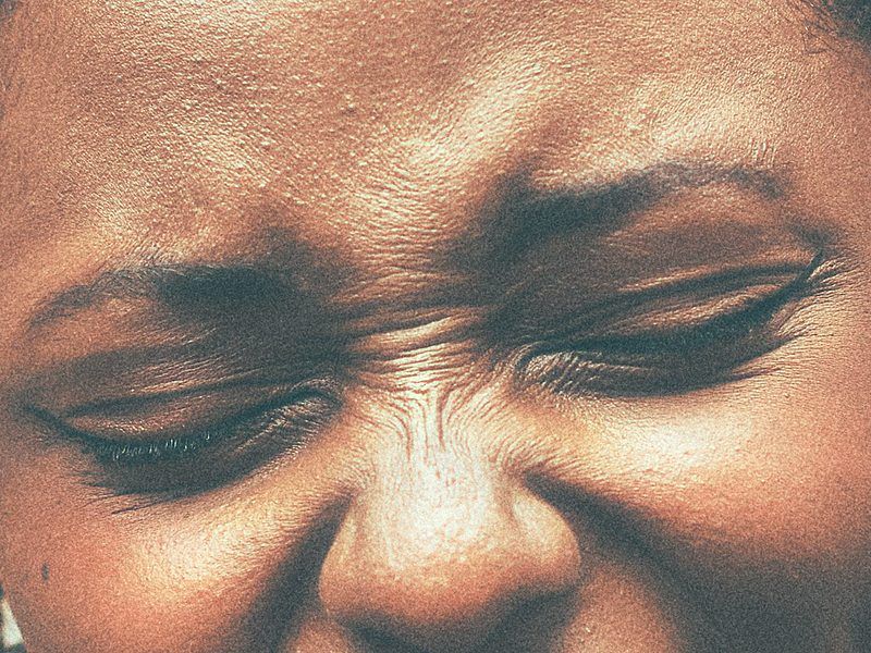 Close-up of the eyes and forehead, with expression lines at the brow and bridge of the nose