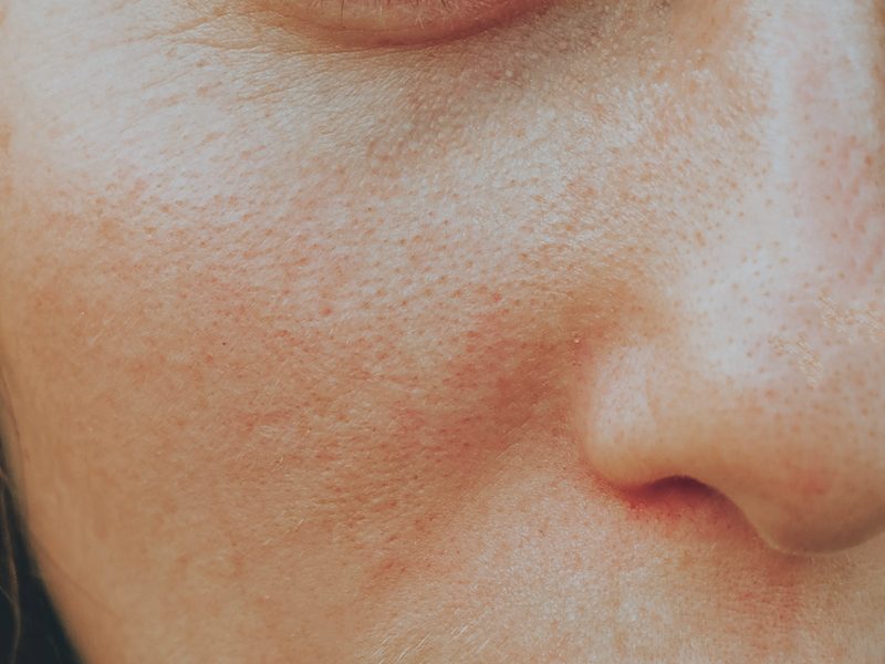 Close-up of the cheek and nose showing visible pores and skin texture